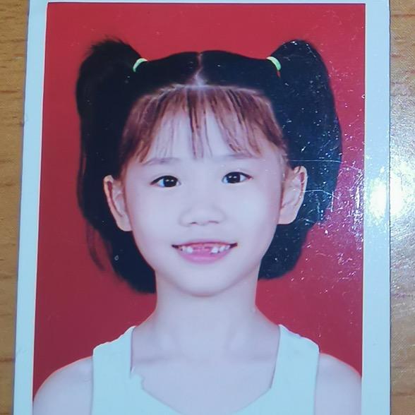 龅牙小恐农