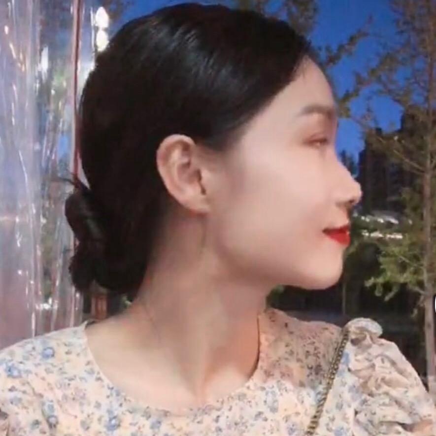 小严阿
