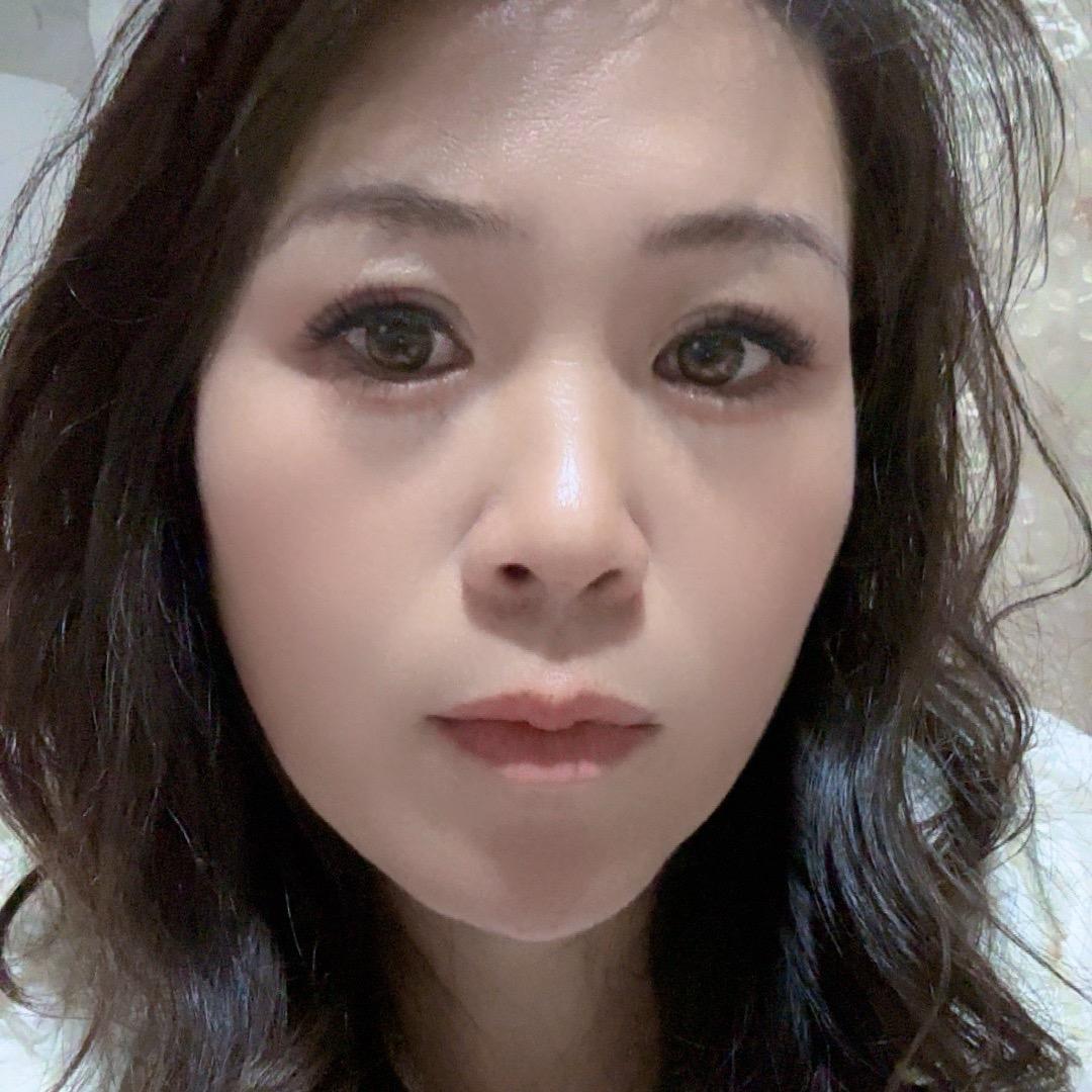 糖糖