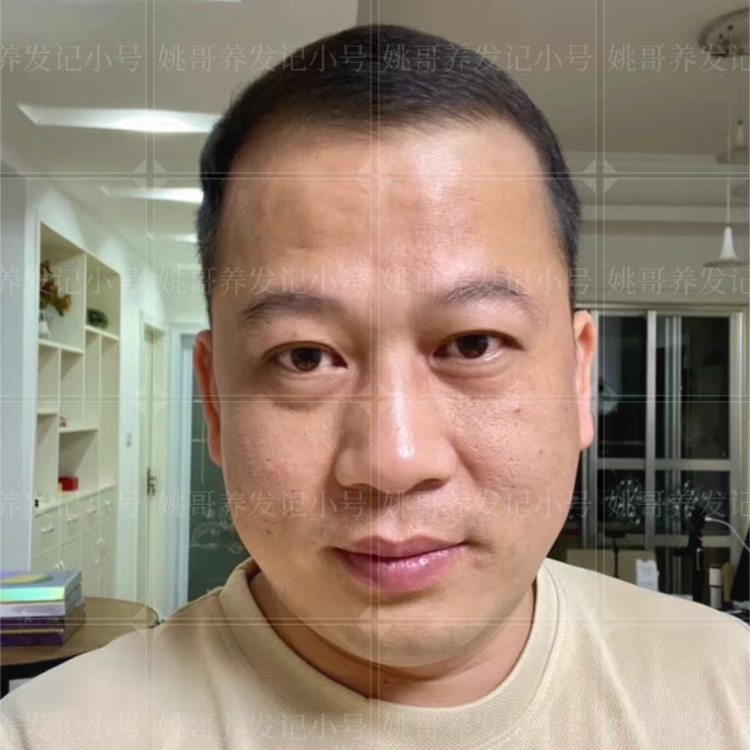 姚哥养发记小号