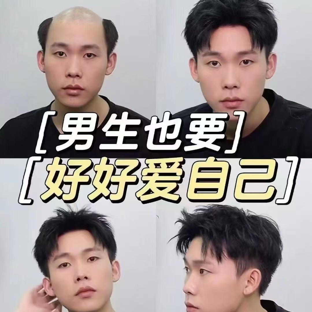 西安小寨假发补发