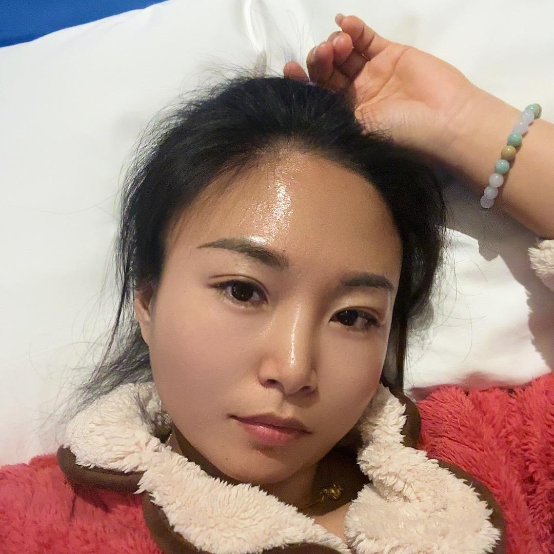 佰草慕斑敏痘|广饶贾姐