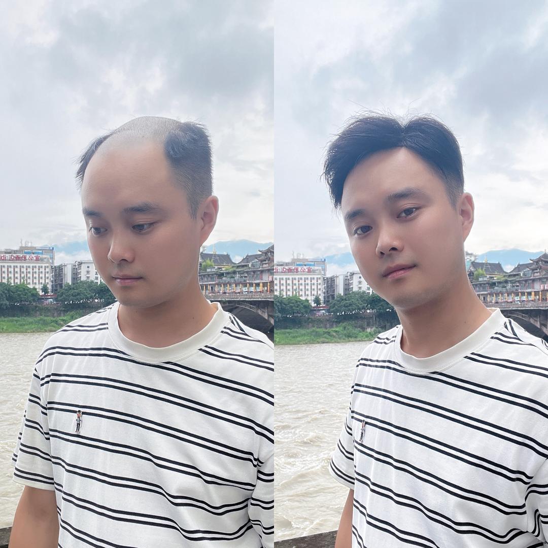 雅安纱龙微男女假发定制（高价回收长头发）