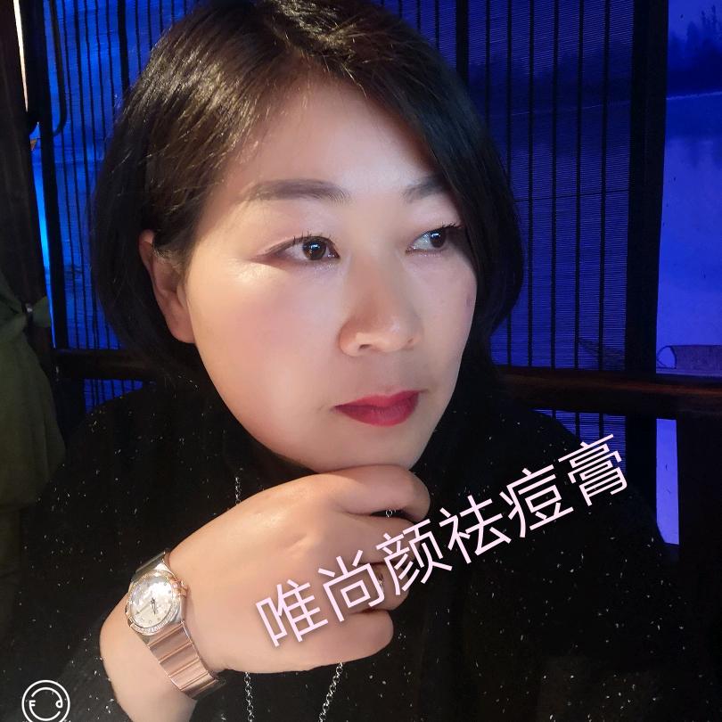 尚阳痘痘膏老板娘