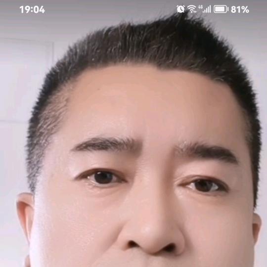 宇宇
