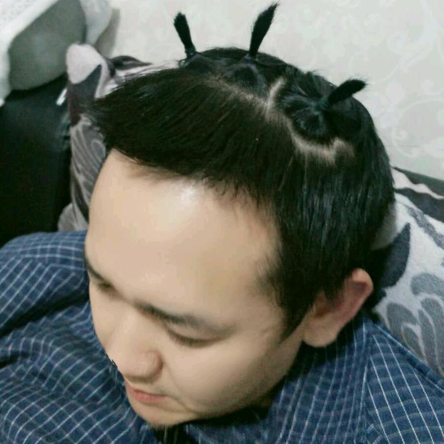 夫哥