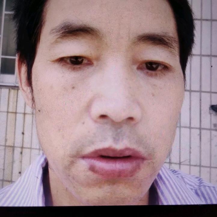 👺鱼山岛👺👺👺