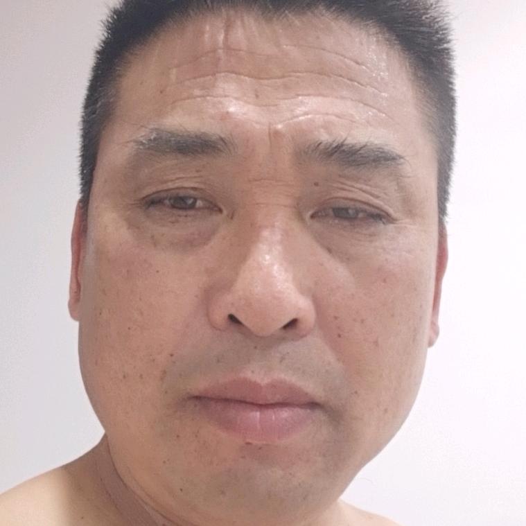 眼镜蛇