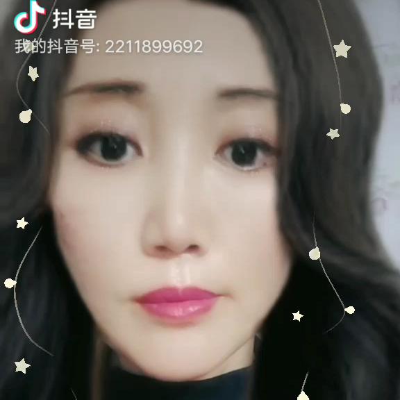 李佳