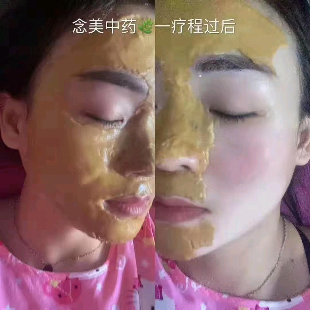 中药面膜林冬梅