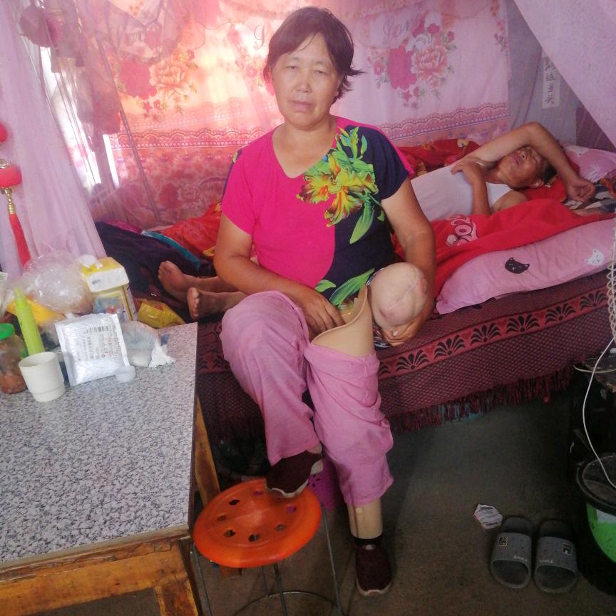 假肢妈妈