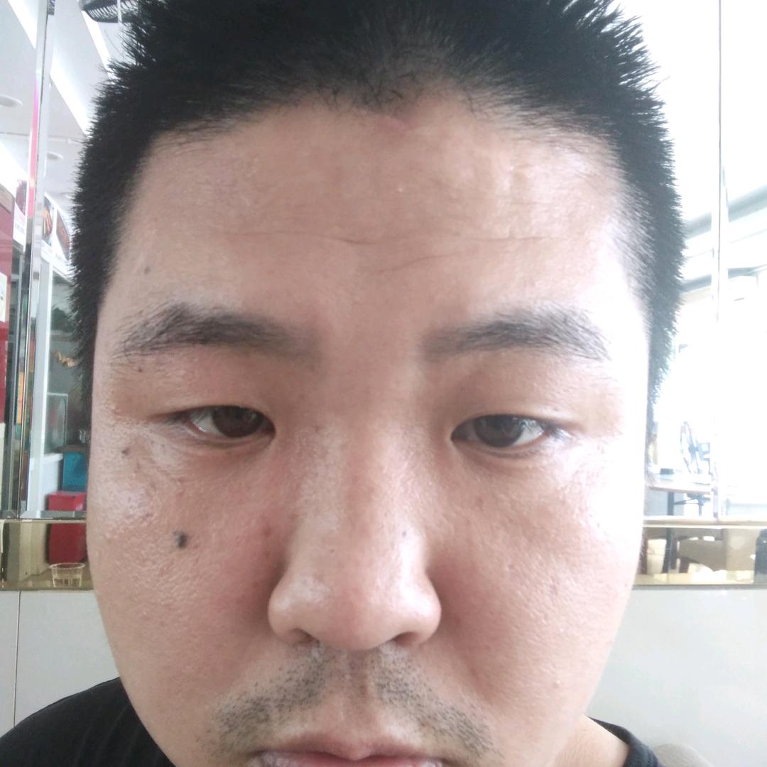 小胖