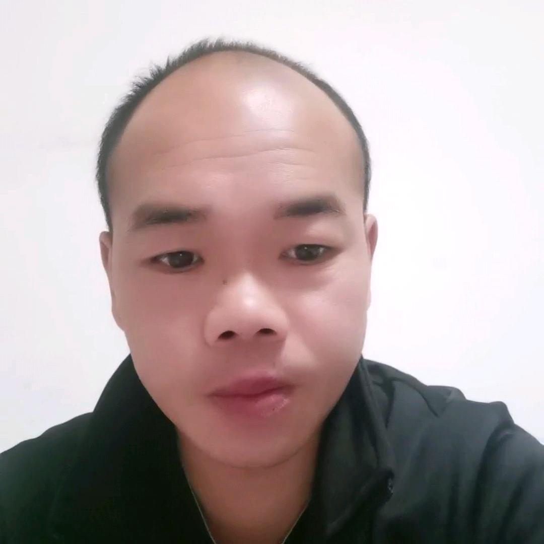 脱发三哥