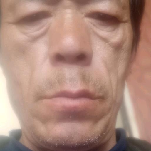 马琳