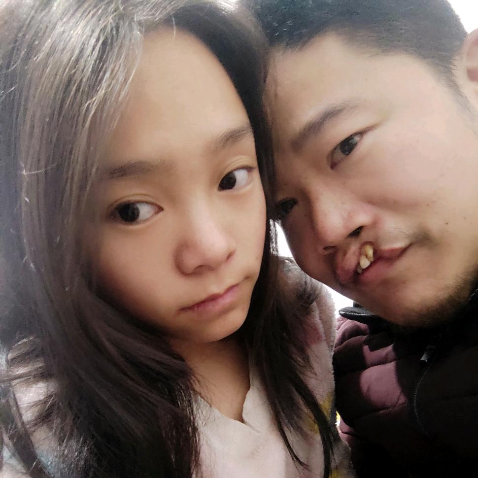 童颜姐与豁嘴哥