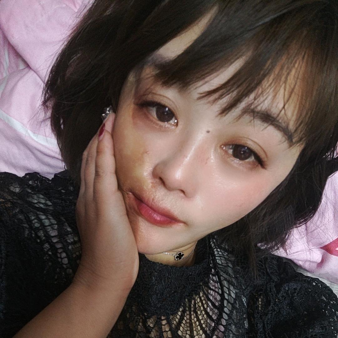 丑妞