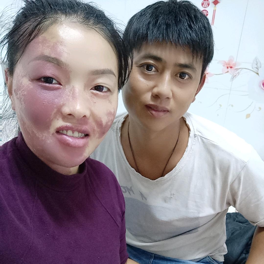 残缺的美丽飞侠