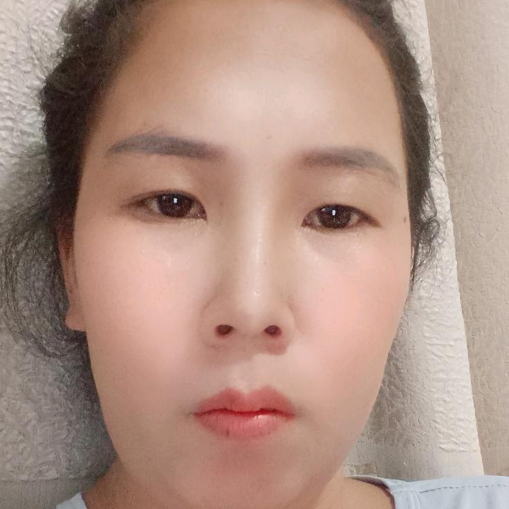 小美