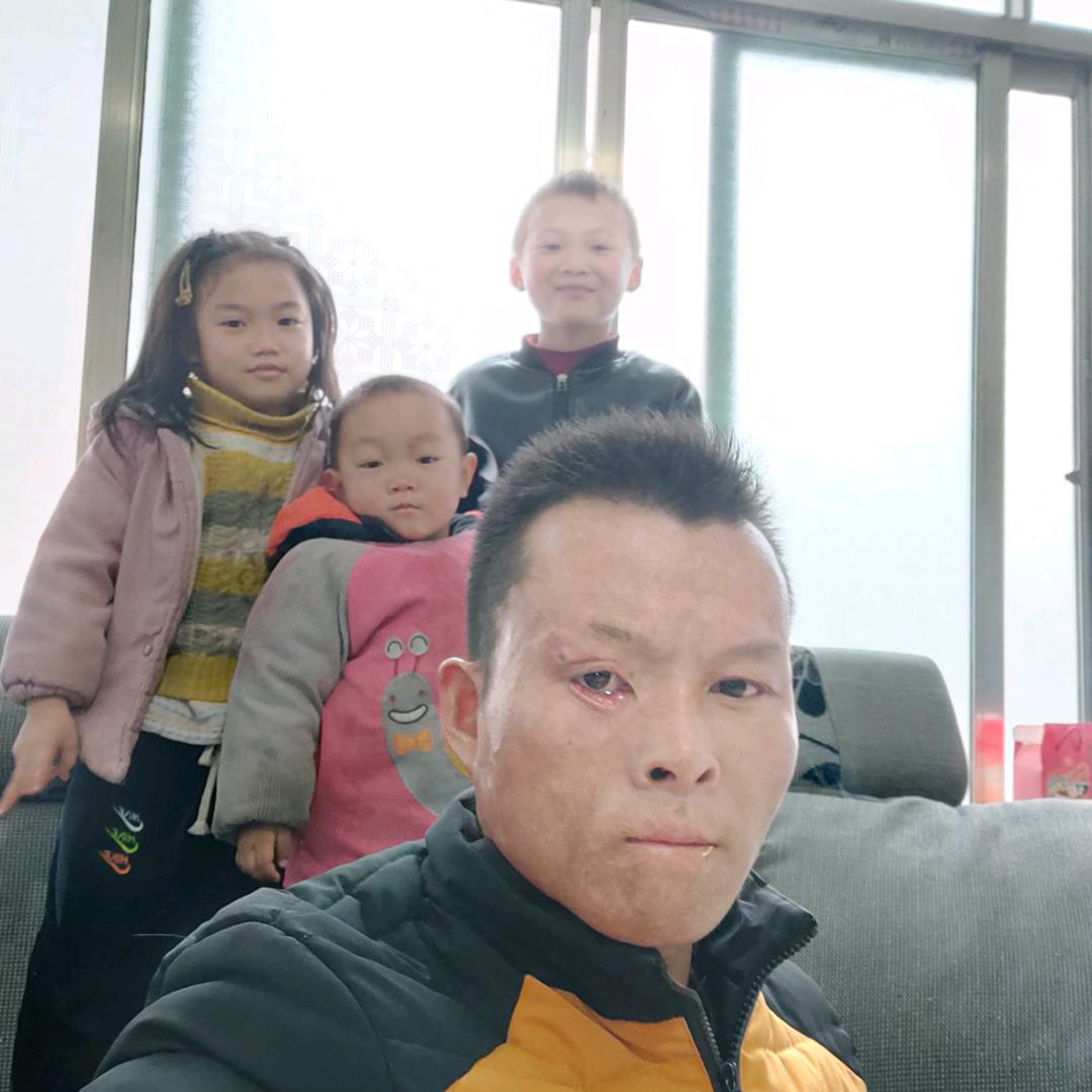 残眼心直