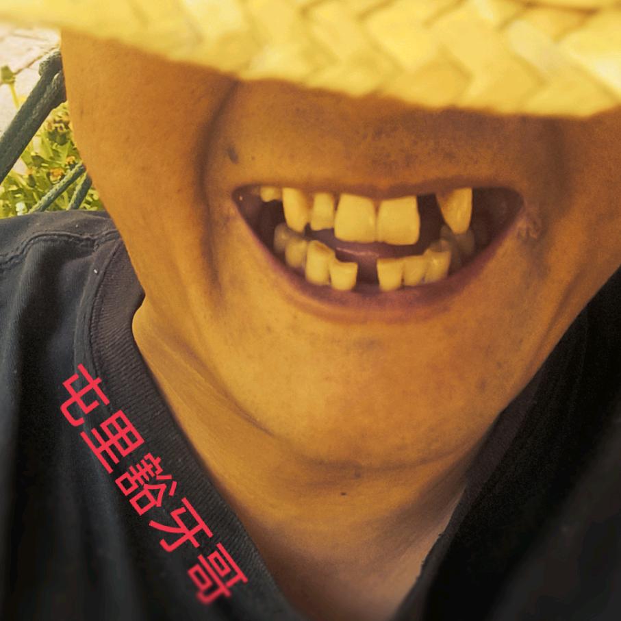 屯里豁牙哥