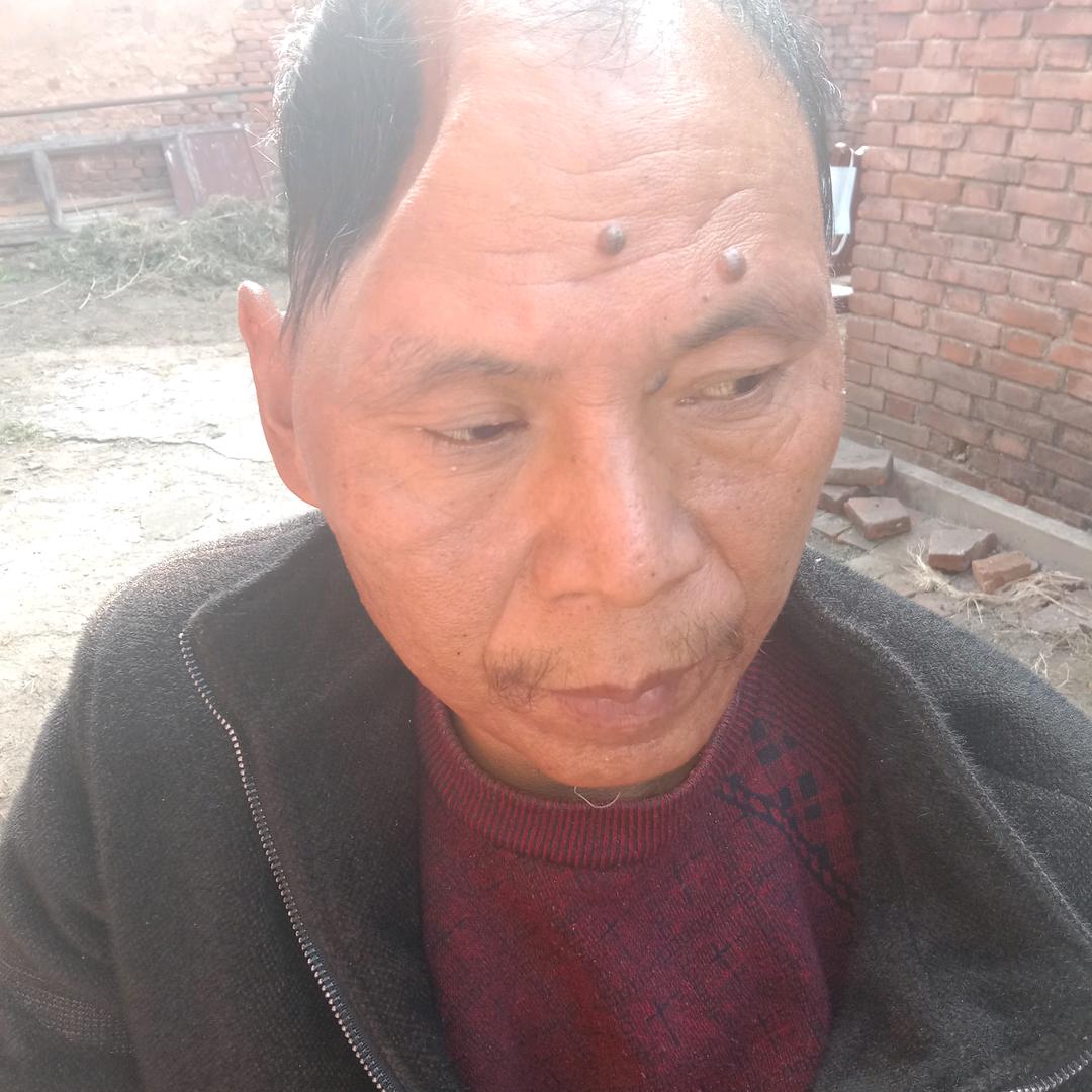 @农村偏瘫人--老王