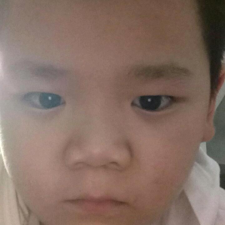 小豆丁