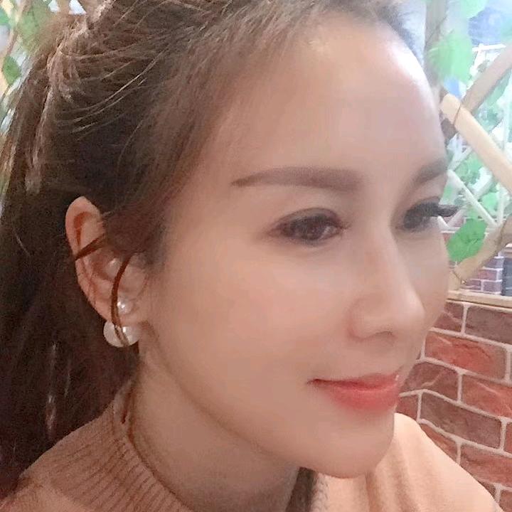 小宏