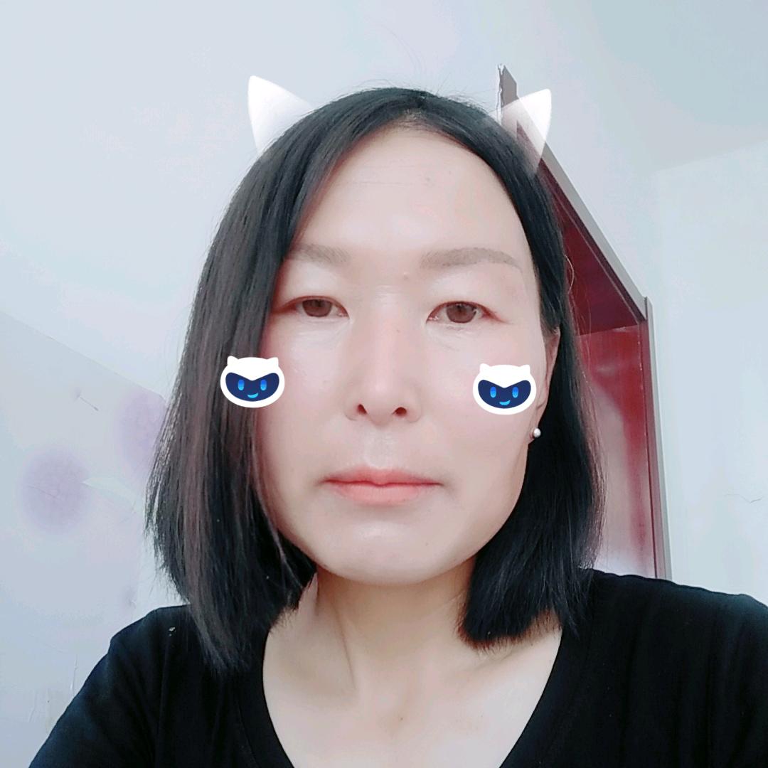 斯琴