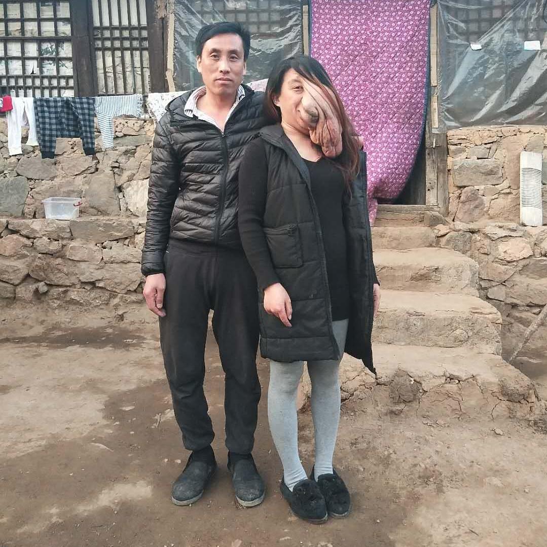 半脸妹 一把手老公