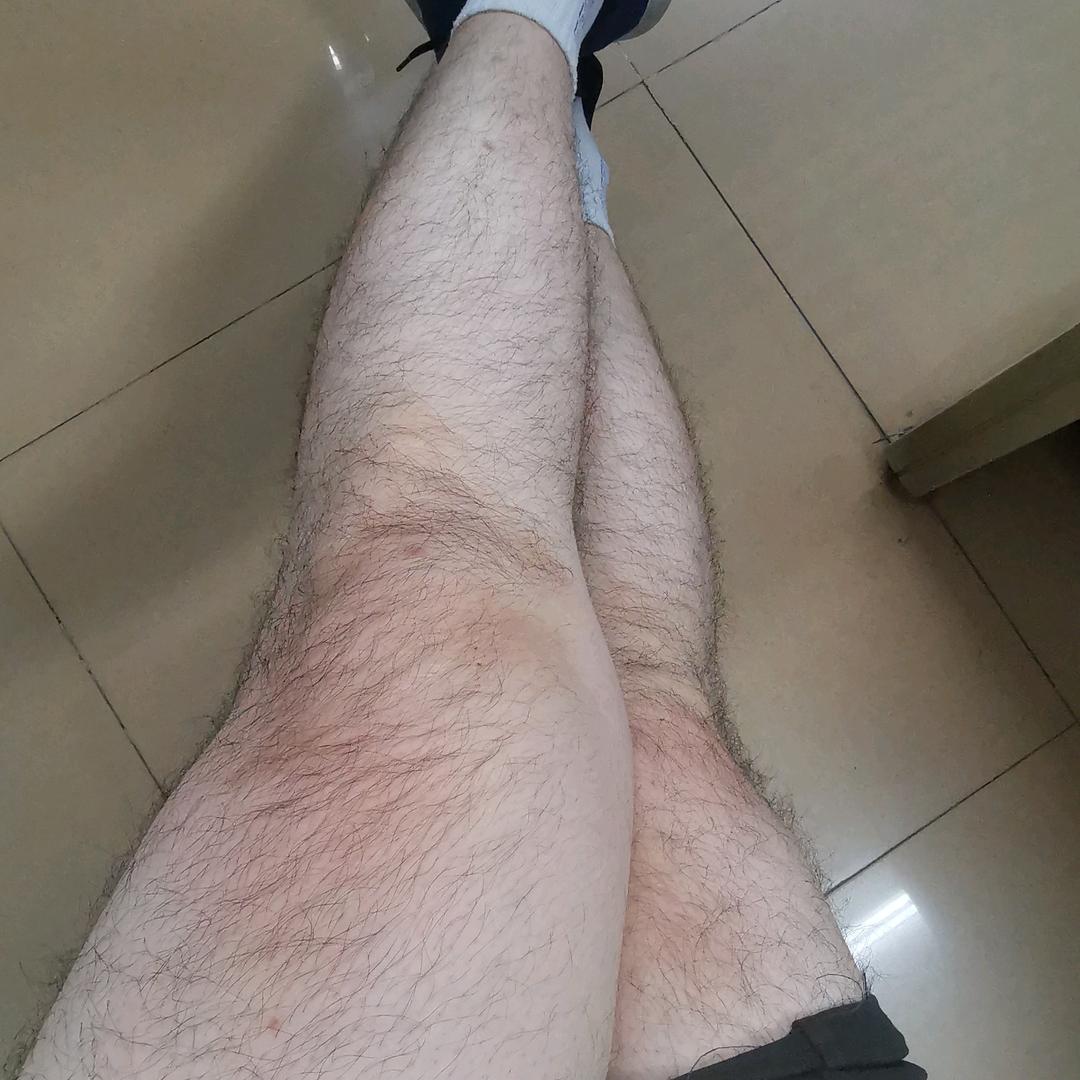 我老婆对脚好多毛