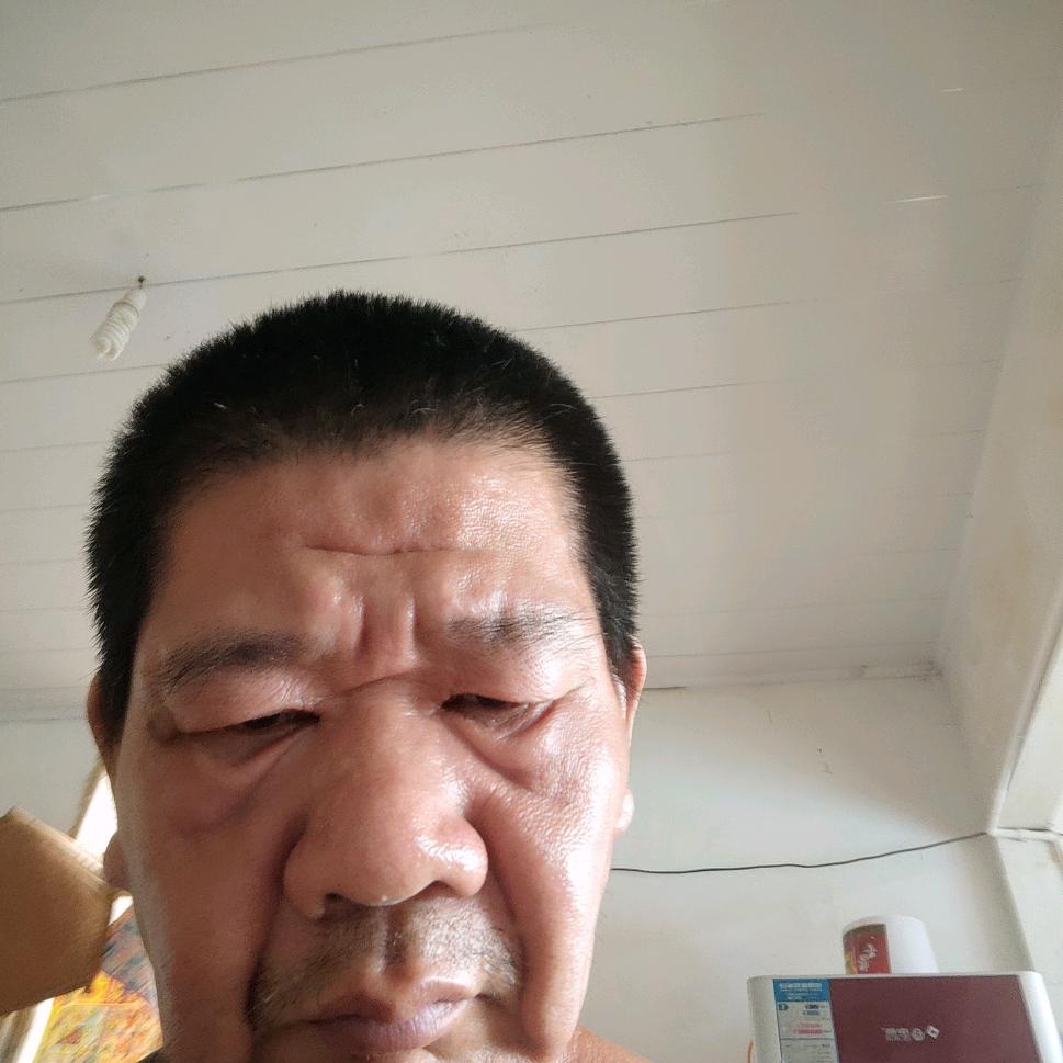 阿友