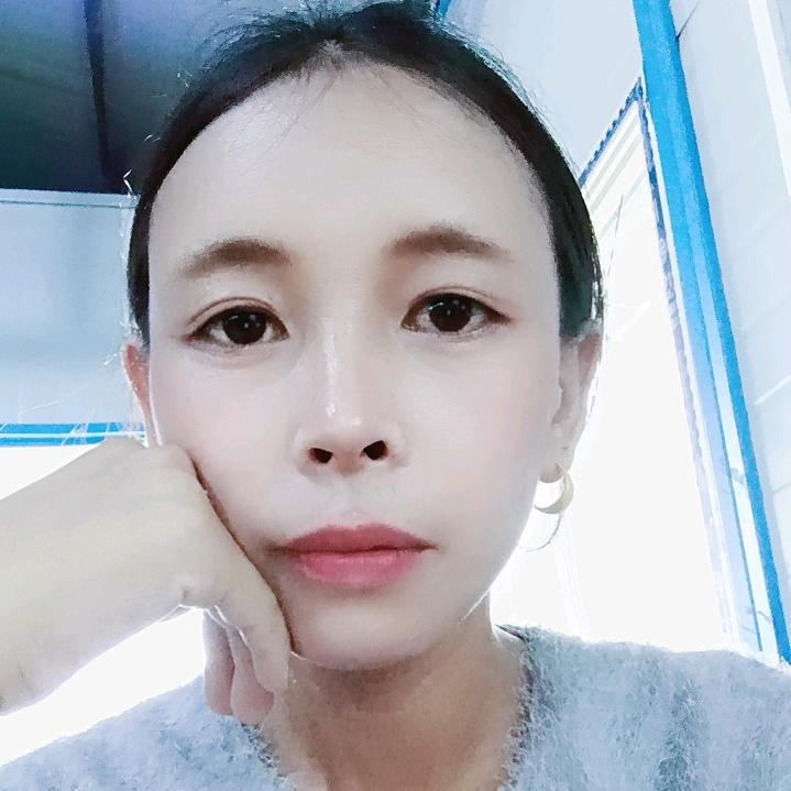 张年