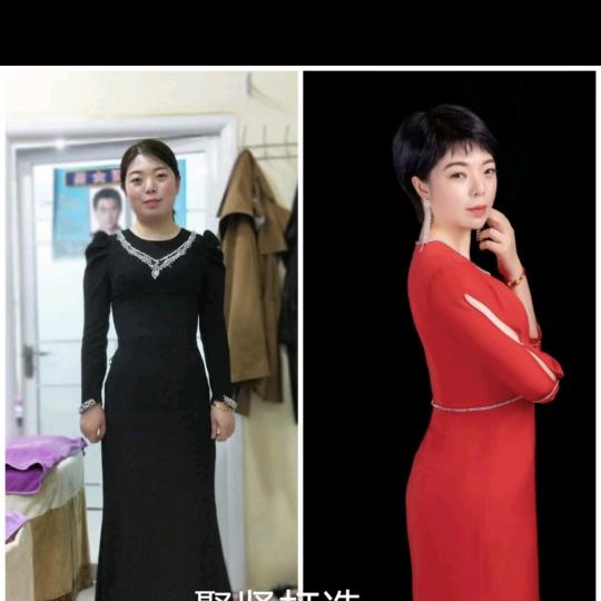 张燕白潭新姿祛（蒙面沙）