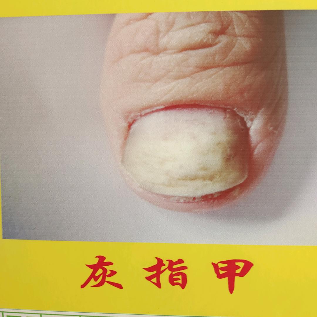 中江县仓山专业修护飞指甲
