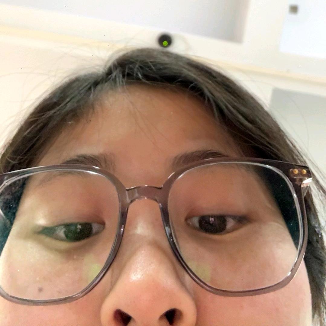 我黑眼圈怎么遮不住