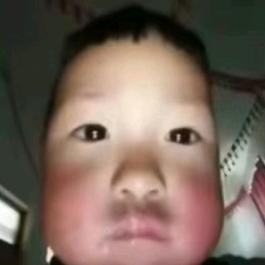 匿迭