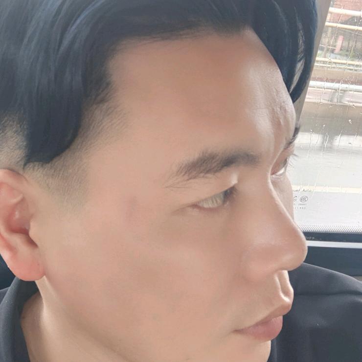 阿照
