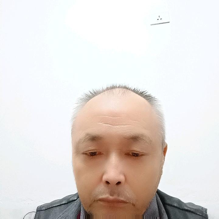 随意？？？？