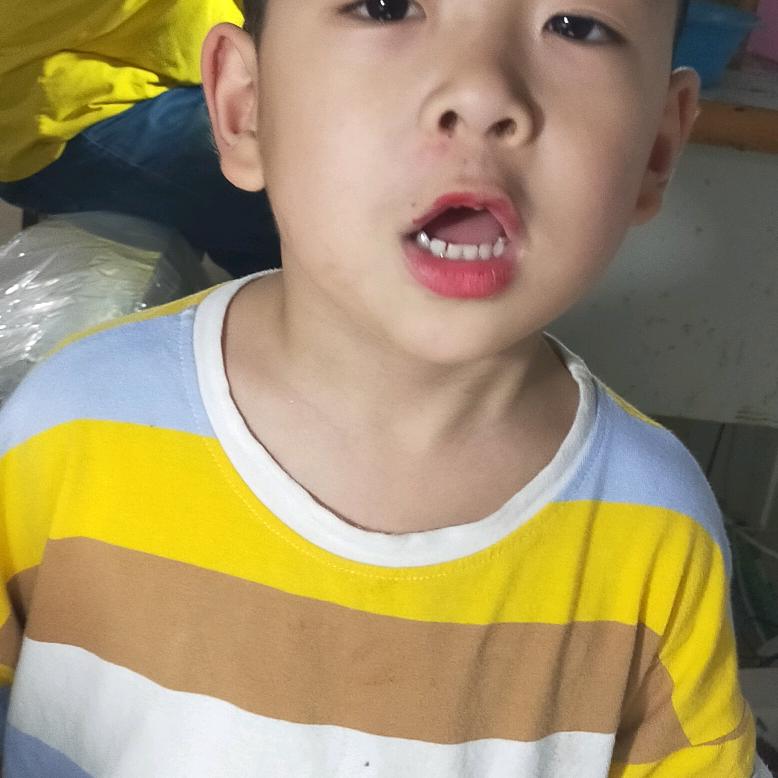 光滴滴