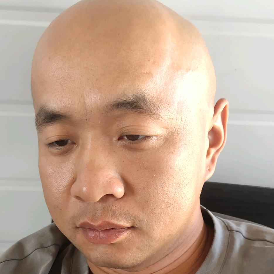 光头林