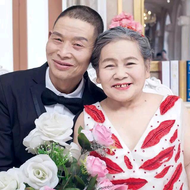 缺牙哥