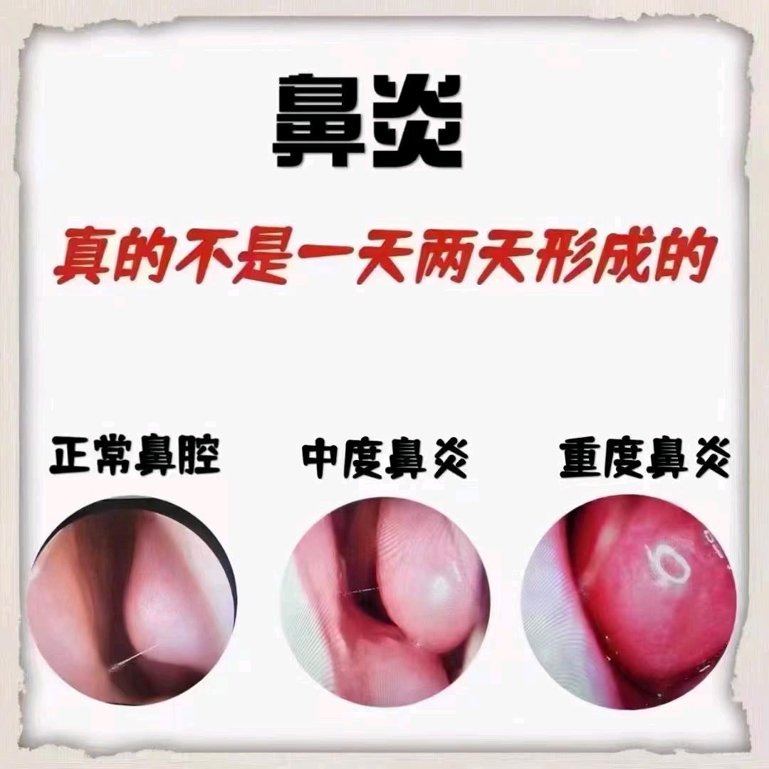 👃🏻当天舒服(公益送)