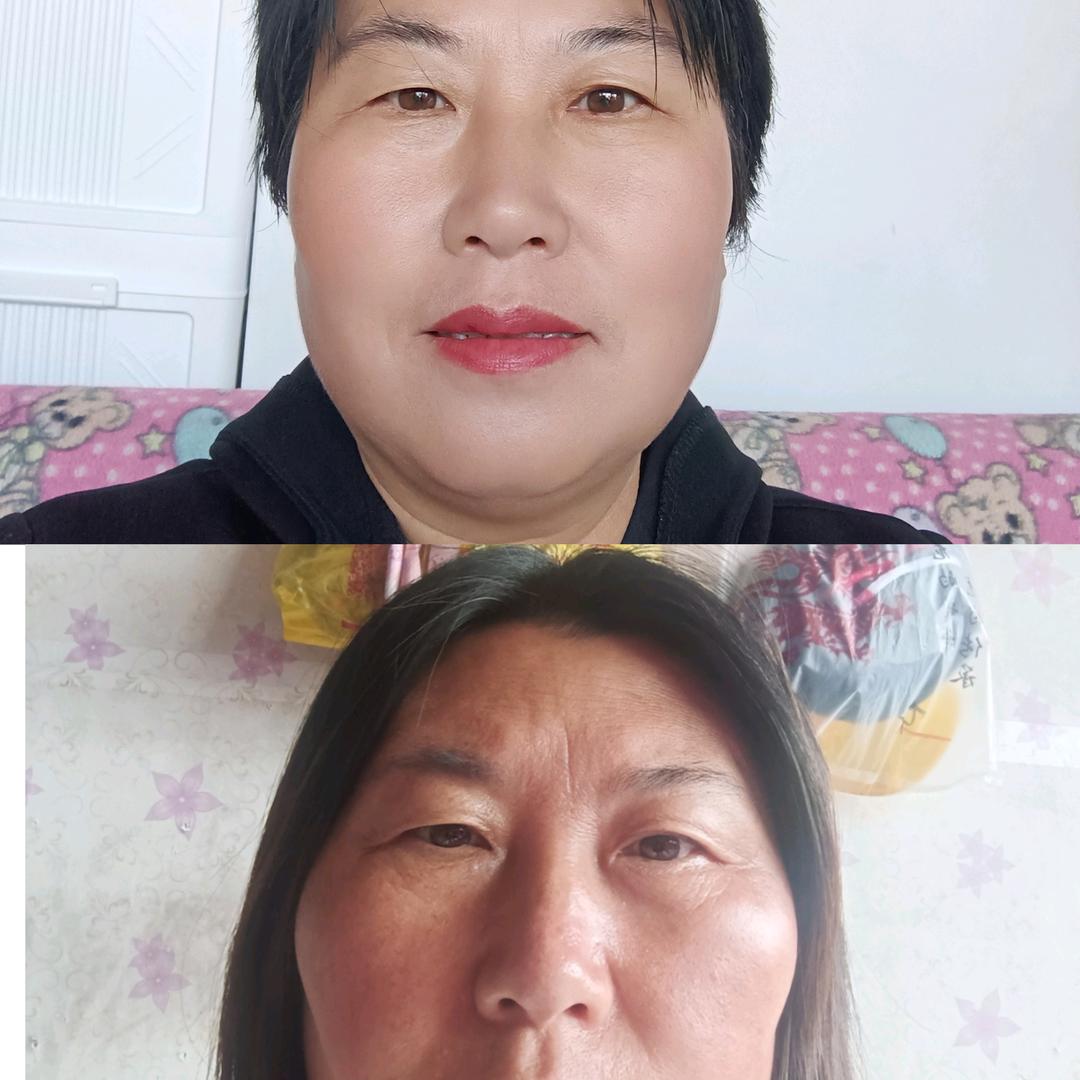 头皮抗衰——全国招商总代理