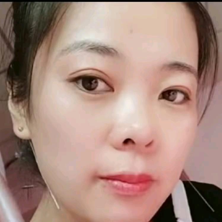 阜平痣尤侯