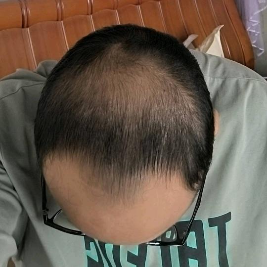 老雷养发