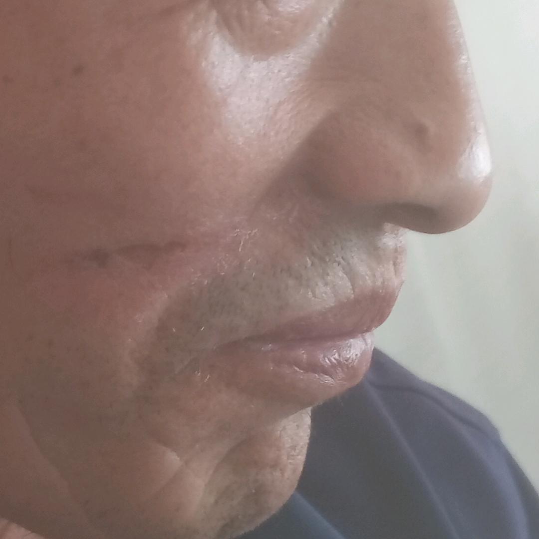 欧玉康