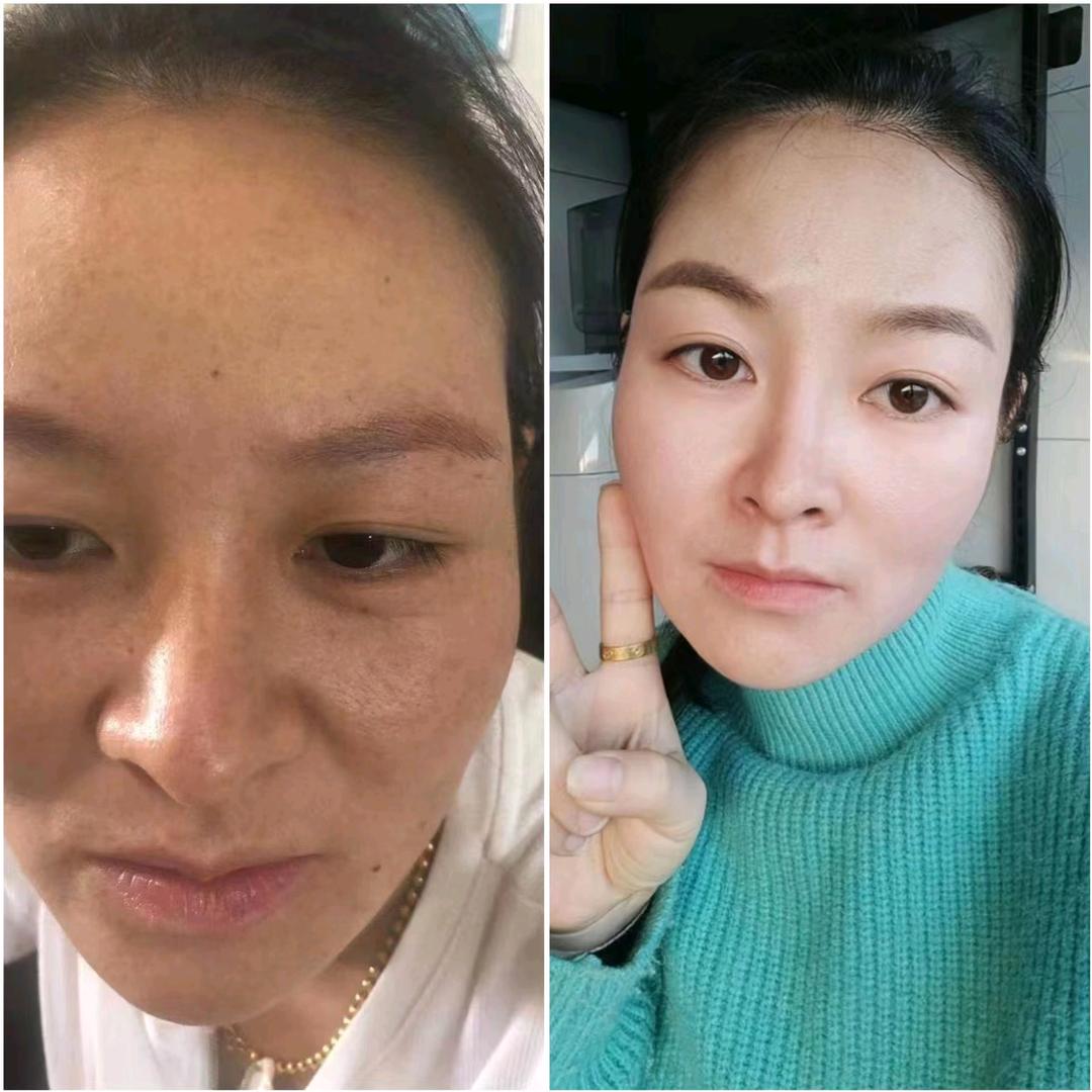 每她颜 ( 祛斑 )