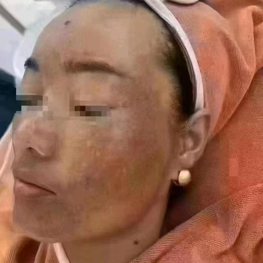 烟台斑老板～姚娟