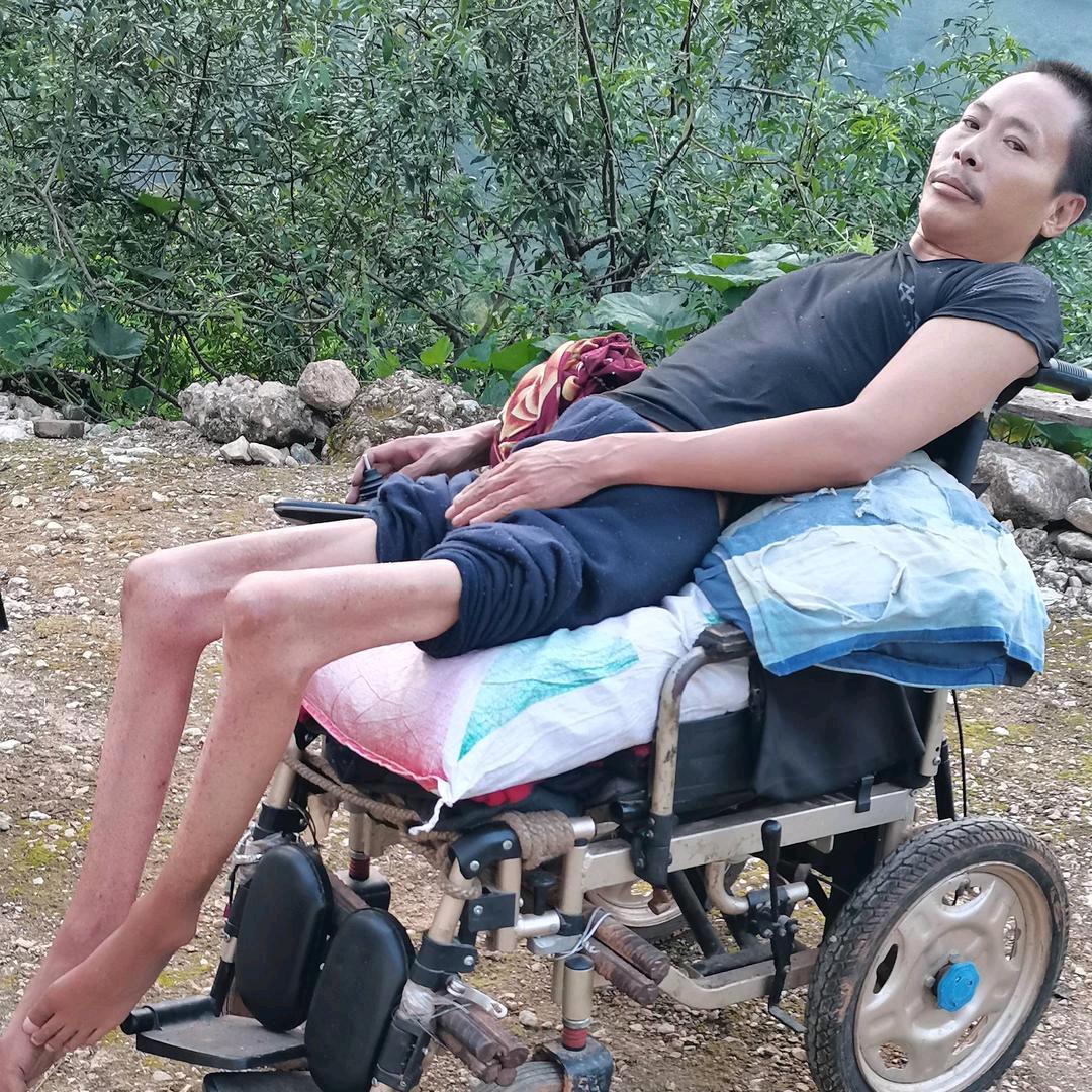 残疾人苏瓦史