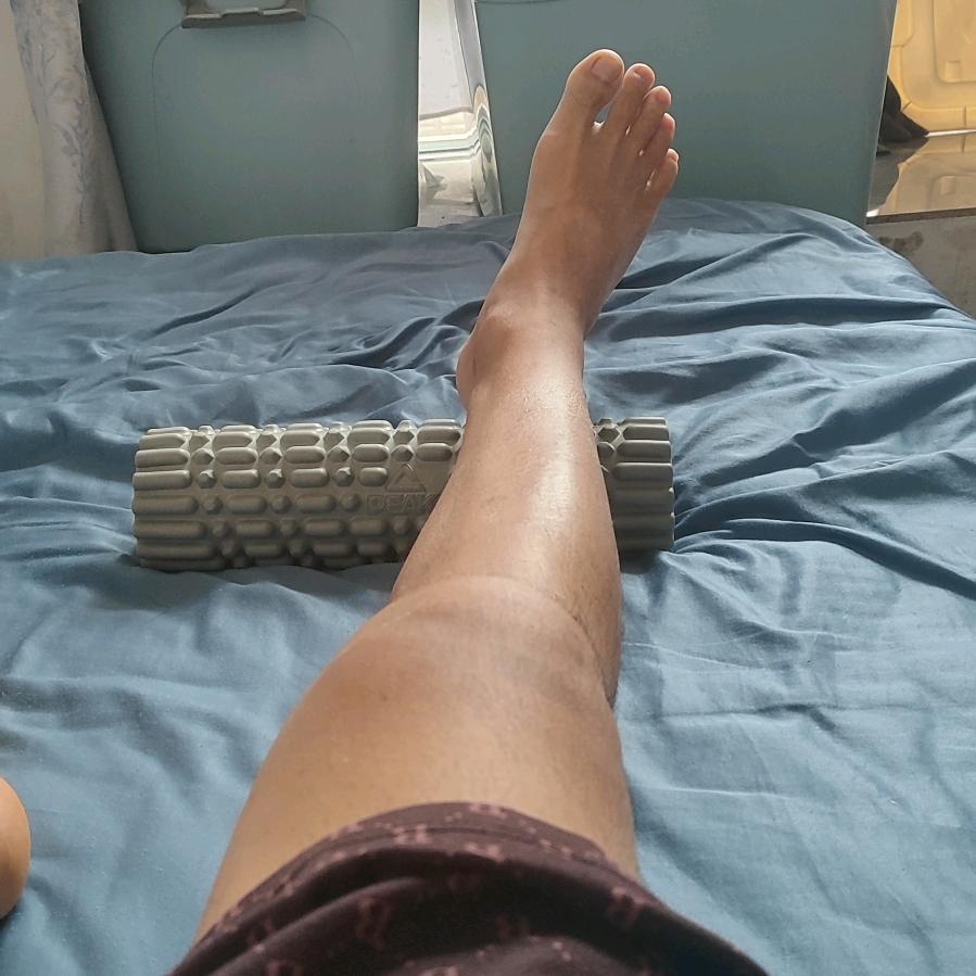 我的半月板术后生活